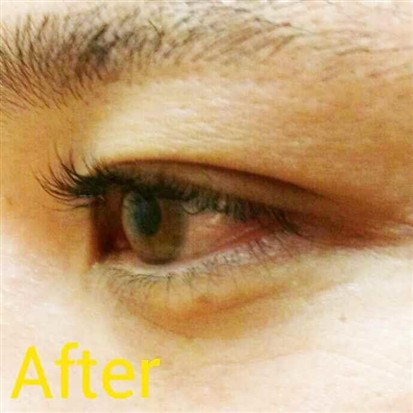沖縄まつげエクステ・那覇まつげエクステ施術後の写真：Cカール8ミリ40本(片目)