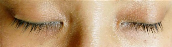 沖縄まつげエクステ・那覇まつげエクステ施術後の写真：Cカール8～10～11㎜