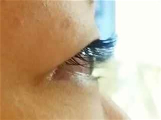 沖縄まつげエクステ・那覇まつげエクステ施術後の写真：まつげのボリューム感アップ