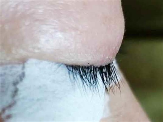 沖縄まつげエクステ・那覇まつげエクステ施術後の写真：まつげのボリューム感アップ