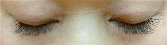 沖縄まつげエクステ・那覇まつげエクステ施術後の写真：目元のオシャレ感アップ