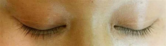 沖縄まつげエクステ・那覇まつげエクステ施術後の写真：目元のオシャレ感アップ