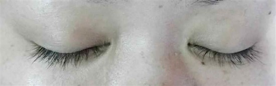 沖縄まつげエクステ・那覇まつげエクステ施術後の写真：目元の印象アップ！