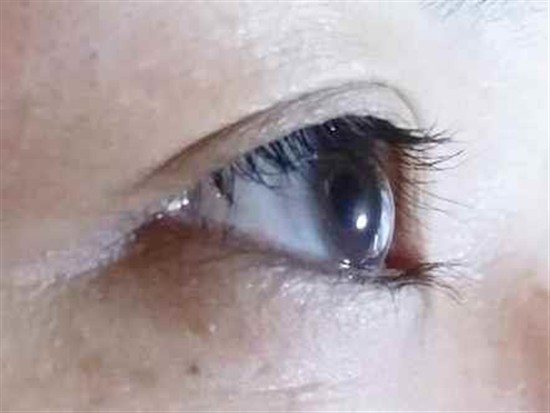 沖縄まつげエクステ・那覇まつげエクステ施術後の写真：目元の印象アップ！