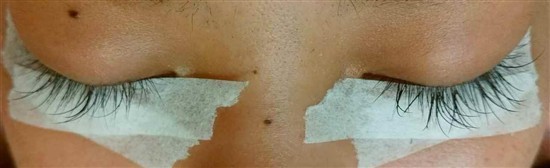 沖縄まつげエクステ・那覇まつげエクステ施術後の写真：明るく印象アップ！
