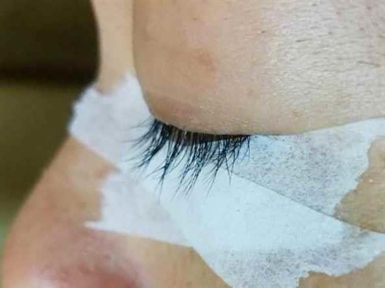 沖縄まつげエクステ・那覇まつげエクステ施術後の写真：ボリュームアップでキレイを実感