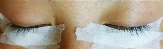 沖縄まつげエクステ・那覇まつげエクステ施術後の写真：ボリュームアップでキレイを実感
