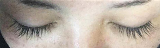 沖縄まつげエクステ・那覇まつげエクステ施術後の写真：ボリュームアップでキレイを実感