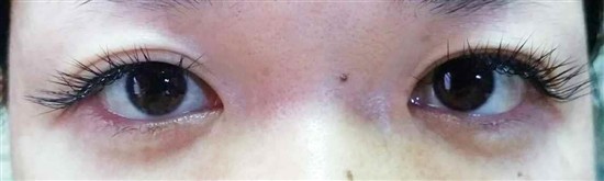 沖縄まつげエクステ・那覇まつげエクステ施術後の写真：くっきり目元でオシャレを演出