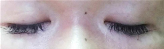 沖縄まつげエクステ・那覇まつげエクステ施術後の写真：くっきり目元でオシャレを演出