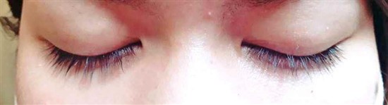 沖縄まつげエクステ・那覇まつげエクステ施術後の写真：まつげエクステ