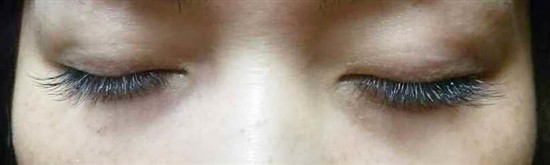 沖縄まつげエクステ・那覇まつげエクステ施術後の写真：美しさは目元から