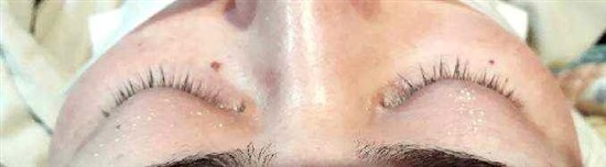 沖縄まつげエクステ・那覇まつげエクステ施術後の写真：フラットマツエク