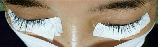 沖縄まつげエクステ・那覇まつげエクステ施術後の写真：毛量アップで印象もアップ