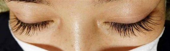 沖縄まつげエクステ・那覇まつげエクステ施術後の写真：毛量アップで印象もアップ