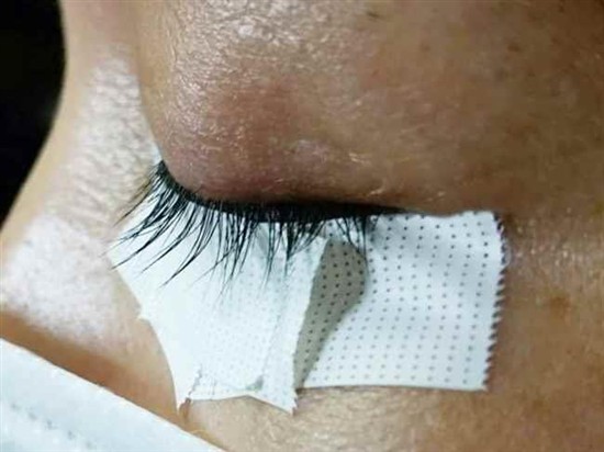 沖縄まつげエクステ・那覇まつげエクステ施術後の写真：毛量アップで印象もアップ