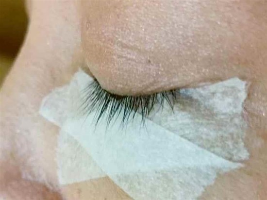 沖縄まつげエクステ・那覇まつげエクステ施術後の写真：毛量アップでメイクを楽に