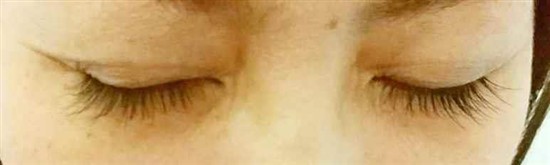 沖縄まつげエクステ・那覇まつげエクステ施術後の写真：毛量アップでメイクを楽に