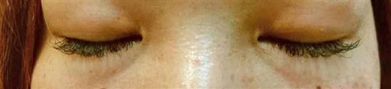 沖縄まつげエクステ・那覇まつげエクステ施術後の写真：まつエク