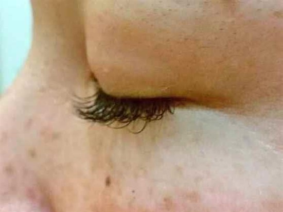 沖縄まつげエクステ・那覇まつげエクステ施術後の写真：まつエク