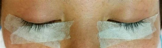 沖縄まつげエクステ・那覇まつげエクステ施術後の写真：まつげ増量でキレイ実感