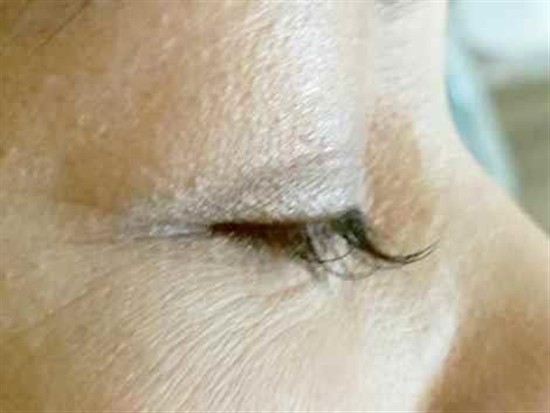 沖縄まつげエクステ・那覇まつげエクステ施術後の写真：デザインマツエク