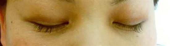 沖縄まつげエクステ・那覇まつげエクステ施術後の写真：デザインマツエク