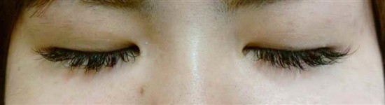 沖縄まつげエクステ・那覇まつげエクステ施術後の写真：キュート目