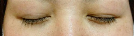 沖縄まつげエクステ・那覇まつげエクステ施術後の写真：デザインマツエク