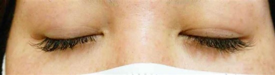 沖縄まつげエクステ・那覇まつげエクステ施術後の写真：デザインマツエク