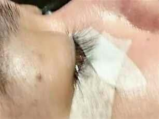 沖縄まつげエクステ・那覇まつげエクステ施術後の写真：目が明るくなりました