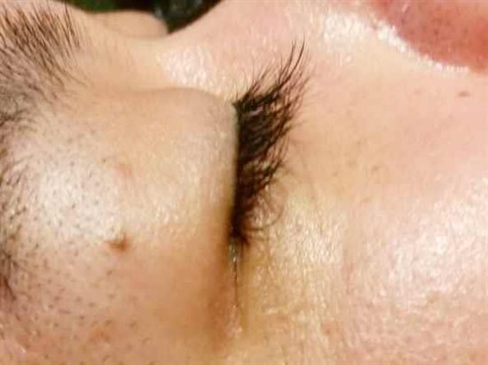 沖縄まつげエクステ・那覇まつげエクステ施術後の写真：目が明るくなりました