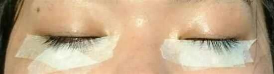 沖縄まつげエクステ・那覇まつげエクステ施術後の写真：目が明るくなりました