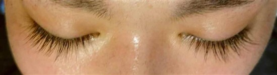 沖縄まつげエクステ・那覇まつげエクステ施術後の写真：目が明るくなりました