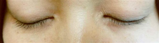 沖縄まつげエクステ・那覇まつげエクステ施術後の写真：派手すぎず華やかに