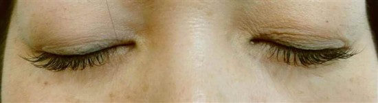 沖縄まつげエクステ・那覇まつげエクステ施術後の写真：派手すぎず華やかに