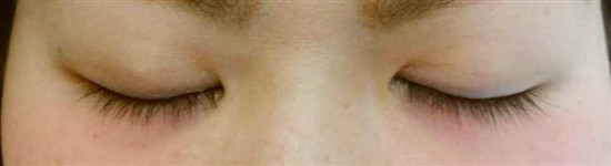 沖縄まつげエクステ・那覇まつげエクステ施術後の写真：自然なボリュームを