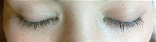 沖縄まつげエクステ・那覇まつげエクステ施術後の写真：デザインマツエク