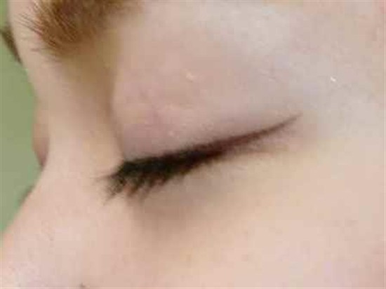 沖縄まつげエクステ・那覇まつげエクステ施術後の写真：真ん中を長めに黒め強調