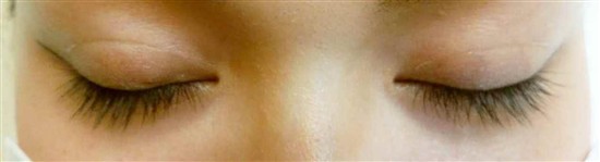 沖縄まつげエクステ・那覇まつげエクステ施術後の写真：真ん中を長めに黒め強調