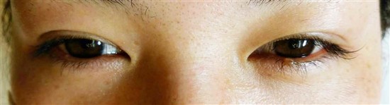 沖縄まつげエクステ・那覇まつげエクステ施術後の写真：大人げなクール&セクシーな目元に