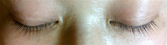 沖縄まつげエクステ・那覇まつげエクステ施術後の写真：デザインマツエク