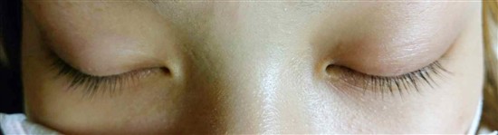 沖縄まつげエクステ・那覇まつげエクステ施術後の写真：ボリュームアップ