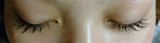 沖縄まつげエクステ・那覇まつげエクステ施術後の写真：ボリュームアップ
