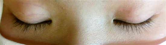 沖縄まつげエクステ・那覇まつげエクステ施術後の写真：逆さまつげがある方でも安心！