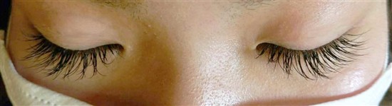 沖縄まつげエクステ・那覇まつげエクステ施術後の写真：逆さまつげがある方でも安心！